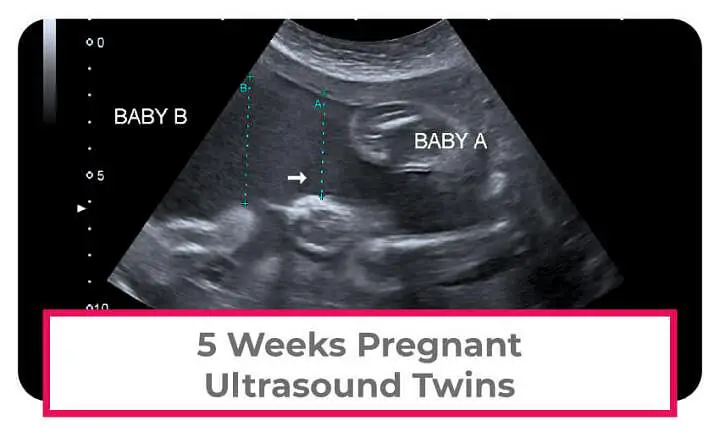 Weeks Pregnant With Twins Symptoms Belly Ultrasound About Twins