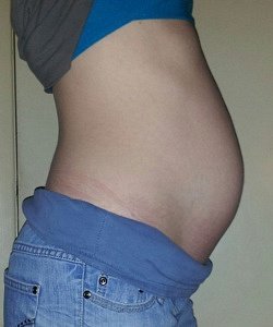 twin pregnancy belly