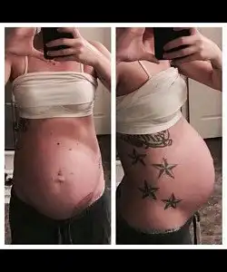 25 Weeks Pregnant Twins Belly Pregnantbelly