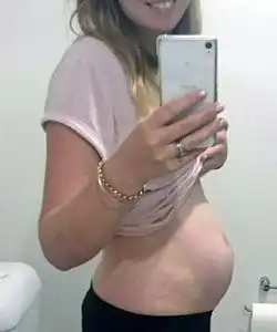 twin pregnancy belly