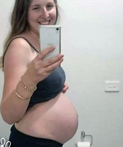 twin pregnancy belly