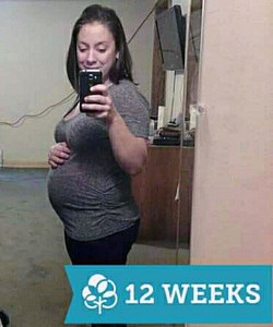 twin pregnancy belly