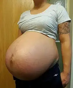 twin pregnancy belly