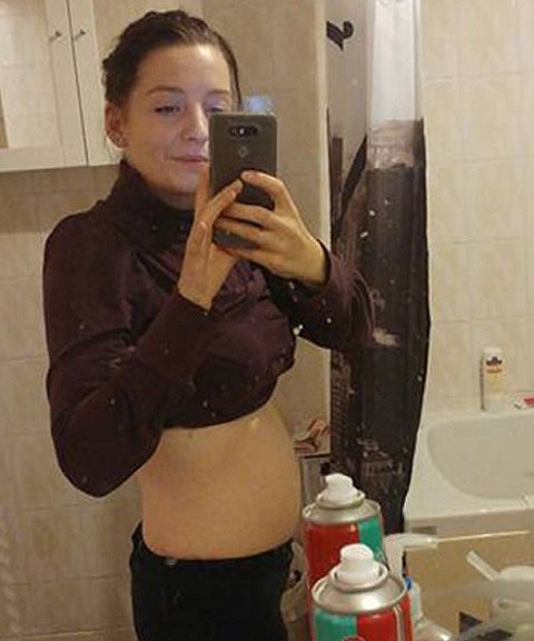 14 Weeks Pregnant With Twins Belly Ultr