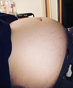 twin pregnancy belly