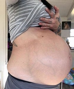 twin pregnancy belly