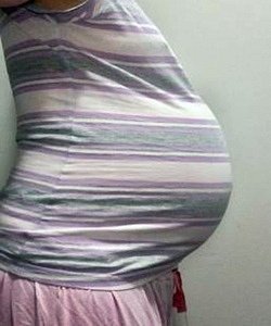 twin pregnancy belly