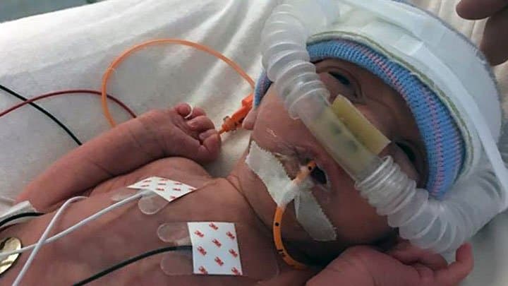 Twin born at 32 weeks