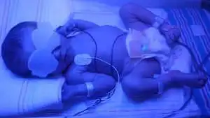 Twin in incubator with jaundice
