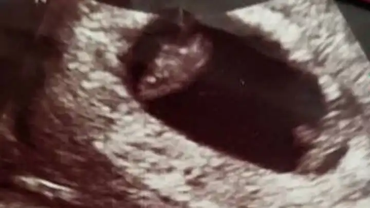 twin ultrasound 6+4 weeks mo-di twins