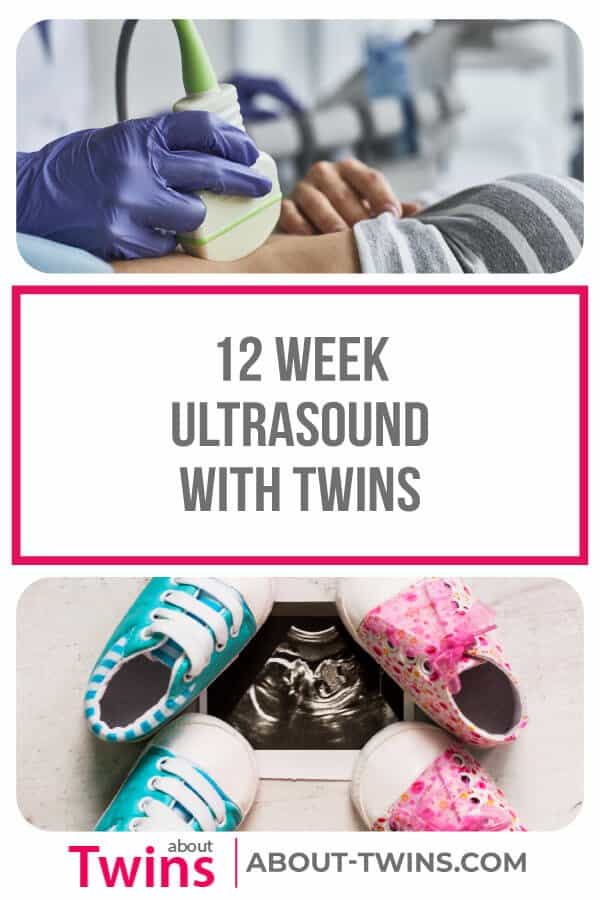Getting excited for the your 12 week twin ultrasound? Here's what you can expect from your appointment. 