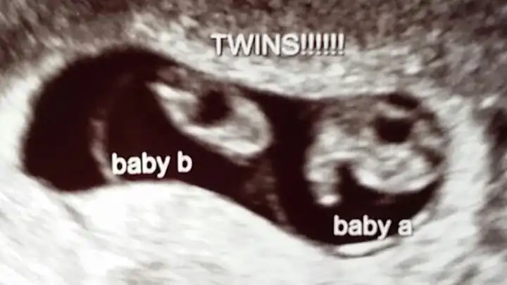 Ultrasound mo-di twins