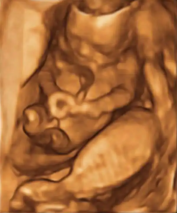 16 Weeks Pregnant With Twins Symptoms Belly And Ultrasound Pictures About Twins 