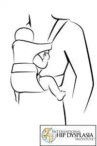 Better way of carrying baby in harness to avoid hip dysplasia or dislocation