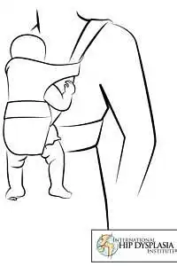 Wrong way of carrying baby in harness to avoid hip dysplasia or dislocation
