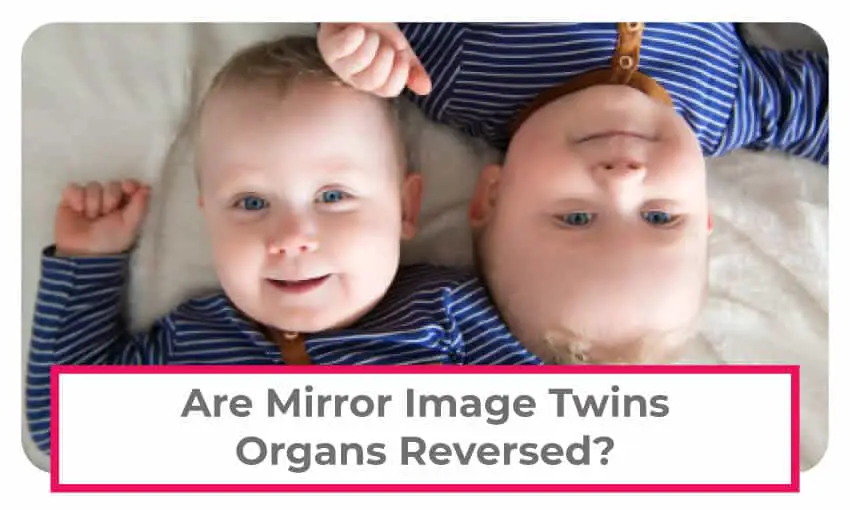 are mirror image twins reversed
