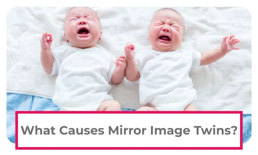 what causes mirror image twins